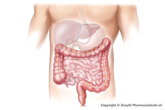 ovarian cancer urine smell squamous papilloma of mouth